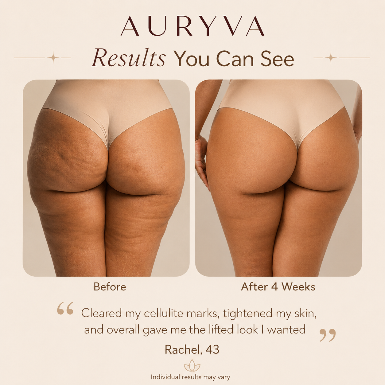 Auryva Restore™